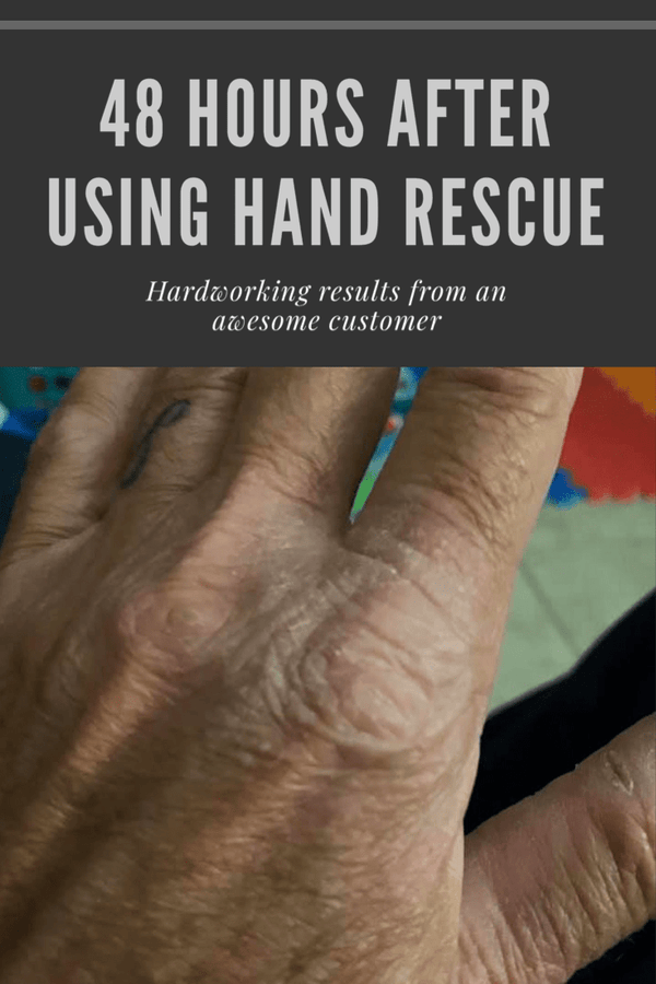 Hand Rescue & Skin Balm - 1 oz - Bawston & Tucker - Body