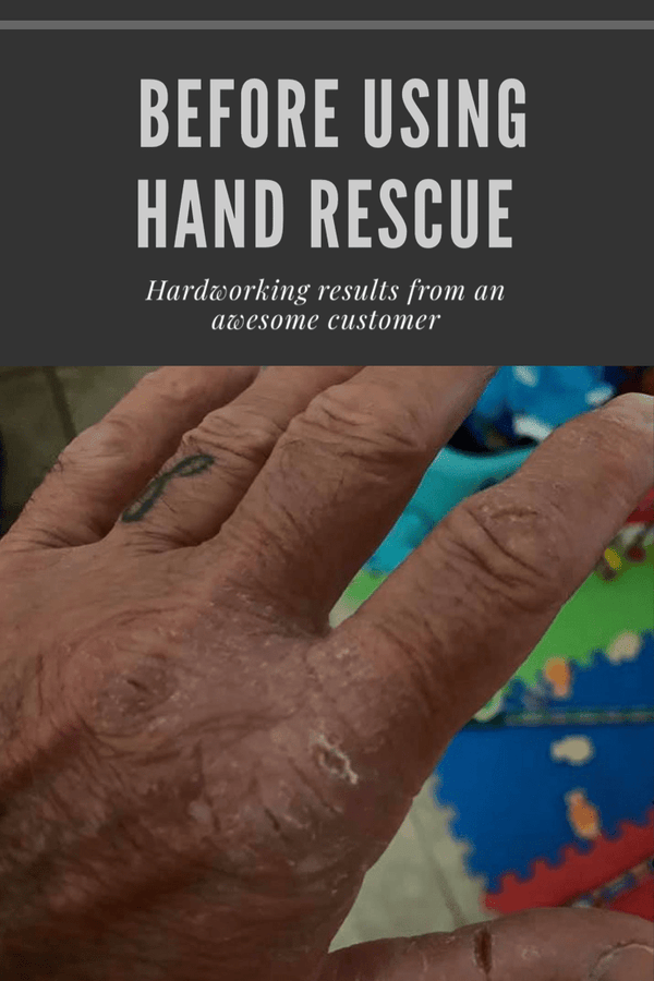 Hand Rescue & Skin Balm - 1 oz - Bawston & Tucker - Body