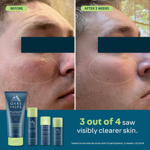 Oars + Alps - NEW Anti-Everything Men's Solid Face Wash Stick - Bawston & Tucker -