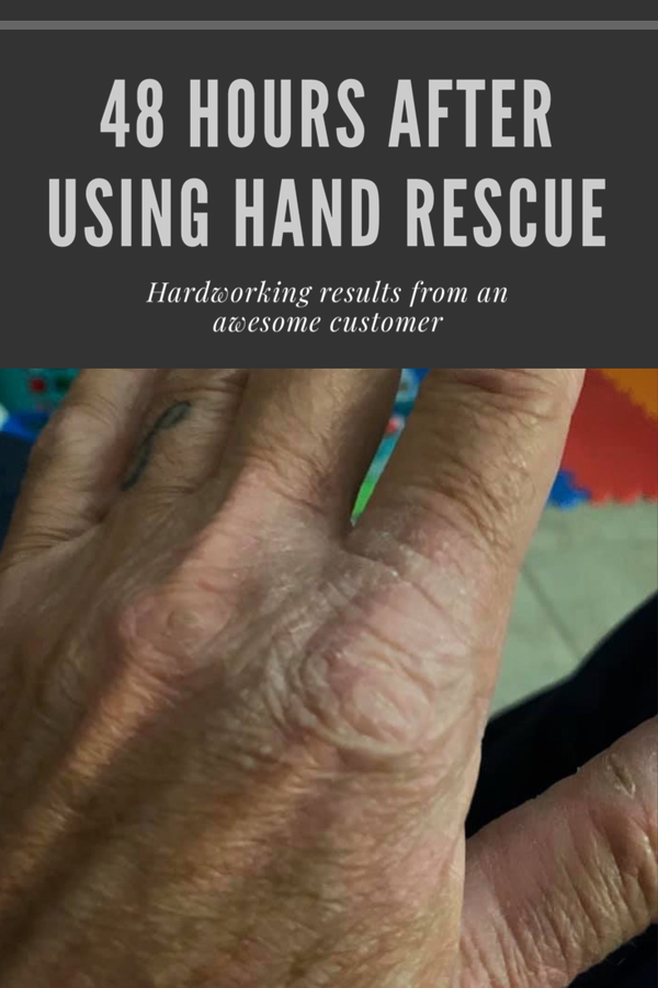Hand Rescue & Skin Balm - 1 oz